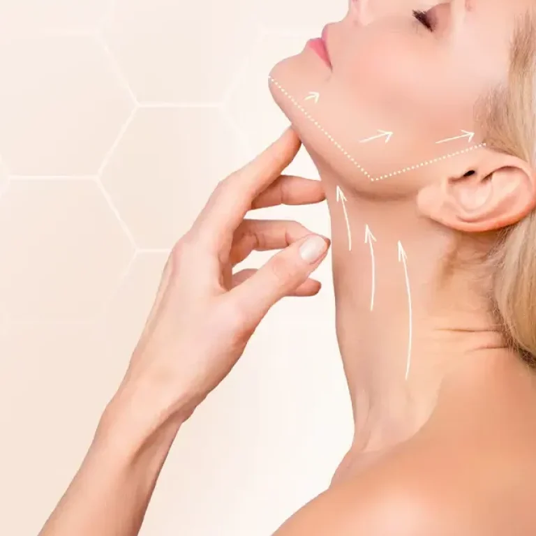 face-neck-lifting-IMG2